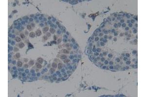 IHC-P analysis of Rat Testis Tissue, with DAB staining. (CPB2 antibody  (AA 164-417))