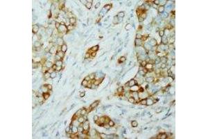 Image no. 1 for anti-V-Akt Murine Thymoma Viral Oncogene Homolog 1/2 (AKT1/2) (N-Term) antibody (ABIN1494209) (AKT1/2 antibody  (N-Term))