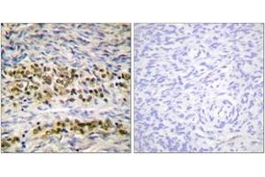 Immunohistochemistry analysis of paraffin-embedded human ovary tissue, using NF-kappaB p105/p50 (Ab-923) Antibody. (NFKB1 antibody  (AA 891-940))