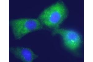 Expression of Kir4. (KCNJ10 antibody  (C-Term, Intracellular))