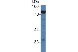 Detection of GARS in Porcine Stomach lysate using Polyclonal Antibody to Glycyl tRNA Synthetase (GARS) (GARS antibody  (AA 567-735))