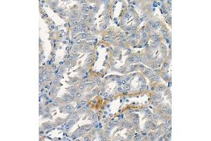 Immunohistochemistry of paraffin embedded rat kidney using Cdcp1 (ABIN7073600) at dilution of 1:300 (400x lens) (CDCP1 antibody)