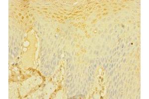 Immunohistochemistry of paraffin-embedded human tonsil tissue using ABIN7147143 at dilution of 1:100 (CD226 antibody  (AA 19-254))