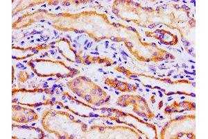 Immunohistochemistry of paraffin-embedded human kidney tissue using ABIN7149308 at dilution of 1:100 (Aconitase 1 antibody  (AA 508-745))