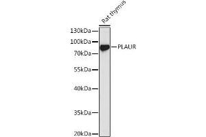 Western blot analysis of extracts of Rat thymus, using PLAUR antibody (ABIN3015469, ABIN3015470, ABIN5663892 and ABIN6218162) at 1:1000 dilution. (PLAUR antibody  (AA 23-305))