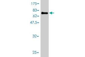 Western Blot detection against Immunogen (63. (NCAPD3 antibody  (AA 1-341))