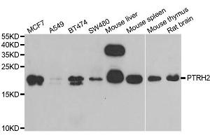Western blot analysis of extracts of various cell lines, using PTRH2 antibody (ABIN5973864) at 1/1000 dilution. (PTRH2 antibody)