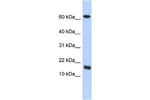 WB Suggested Anti-C4orf46 Antibody Titration: 0. (C4orf46 antibody  (Middle Region))