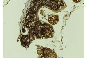 ABIN6276559 at 1/100 staining Mouse colon tissue by IHC-P. (LSD1 antibody  (Internal Region))