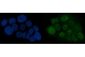 IF analysis of ATR using anti-ATR antibody (ABIN7600806).