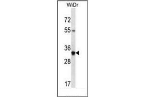 Western blot analysis of OR2W5 Antibody (C-term) in WiDr cell line lysates (35ug/lane).
