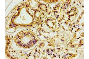 Immunohistochemistry (IHC) image for anti-Platelet/endothelial Cell Adhesion Molecule (PECAM1) (AA 28-315) antibody (ABIN7147154)