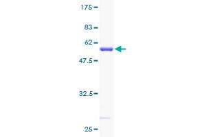 Image no. 1 for Ribosomal Protein S3 (RPS3) (AA 1-243) protein (GST tag) (ABIN1318801) (RPS3 Protein (AA 1-243) (GST tag))