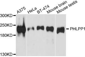 Western blot analysis of extracts of various cell lines, using PHLPP1 antibody. (PHLPP1 antibody)