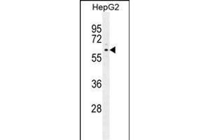 ARD Antibody (C-term) (ABIN655880 and ABIN2845281) western blot analysis in HepG2 cell line lysates (35 μg/lane). (PPARD antibody  (C-Term))