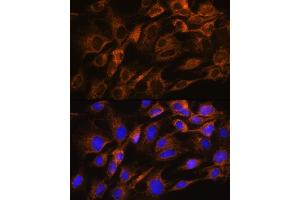 Immunofluorescence analysis of C6 cells using  Rabbit pAb (ABIN6133587, ABIN6137053, ABIN6137054 and ABIN6224632) at dilution of 1:100. (Aquaporin 8 antibody  (AA 50-150))