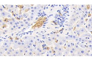 Detection of HBb in Bovine Liver Tissue using Polyclonal Antibody to Hemoglobin Beta (HBb) (Hemoglobin Subunit beta antibody  (AA 1-145))