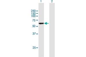 Western Blot analysis of CCDC6 expression in transfected 293T cell line by CCDC6 MaxPab polyclonal antibody. (CCDC6 antibody  (AA 1-474))