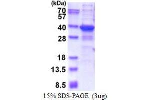 TGFB-Induced Factor Homeobox 2-Like, X-Linked (TGIF2LX) (AA 1-241) protein (His tag)