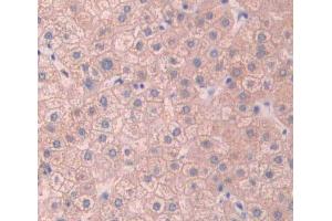 Used in DAB staining on fromalin fixed paraffin- embedded Kidney tissue (ABCB11 antibody  (AA 421-663))