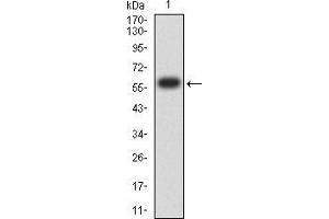 Western blot analysis using KDM1A mAb against human KDM1A (AA: 55-263) recombinant protein.