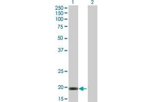 Western Blot analysis of VSTM2L expression in transfected 293T cell line by VSTM2L MaxPab polyclonal antibody. (VSTM2L antibody  (AA 1-204))