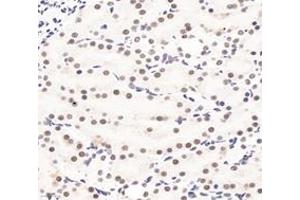 Immunohistochemistry (Paraffin-embedded Sections) (IHC (p)) image for anti-Polyglutamine Binding Protein 1 (PQBP1) antibody (ABIN7075126)