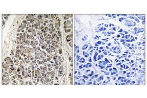 Immunohistochemistry analysis of paraffin-embedded human pancreas tissue using MRPS21 antibody. (MRPS21 antibody  (Internal Region))