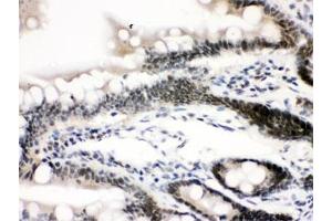 IHC testing of FFPE rat intestine with CTCF antibody. (CTCF antibody  (AA 521-727))