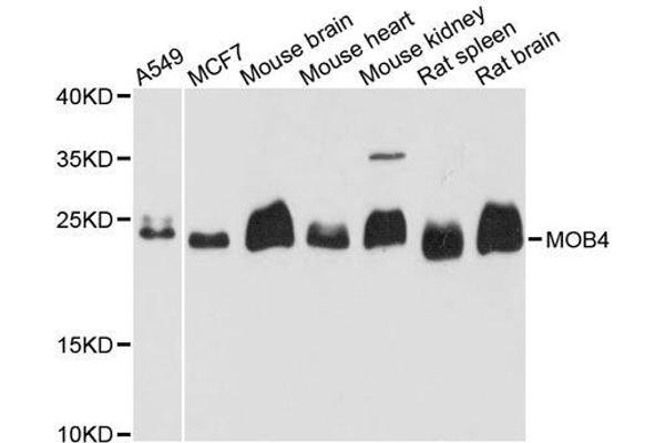 MOBKL3 Antikörper  (AA 1-225)
