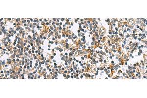 Immunohistochemistry of paraffin-embedded Human tonsil tissue using GUCA1A Polyclonal Antibody at dilution of 1:105(x200) (GCAP1 antibody)