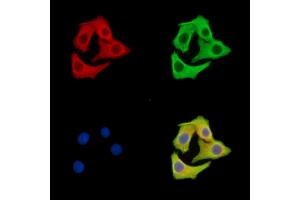 ABIN7095985 and ABIN7100047 staining Hela cells by IF/ICC.