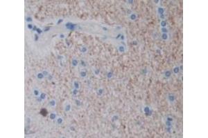 Figure. (CSN3 antibody  (AA 24-181))