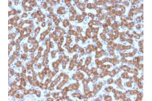 Formalin-fixed, paraffin-embedded human Liver stained with Prohibitin Mouse Monoclonal Antibody (PHB/3227). (Prohibitin antibody  (AA 167-261))
