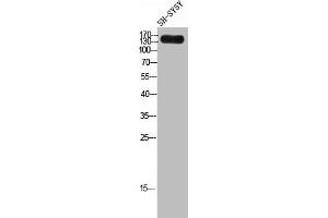 Western Blot analysis of SH-SY5Y cells using Laminin γ-3 Polyclonal Antibody (LAMC3 antibody  (C-Term))