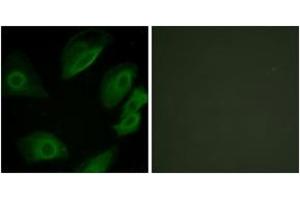 Immunofluorescence analysis of HeLa cells, using Lck (Ab-505) Antibody. (LCK antibody  (AA 460-509))