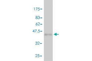 Western Blot detection against Immunogen (42. (Neuroglobin antibody  (AA 1-151))