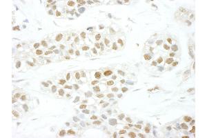 anti-Transcription Elongation Factor A (SII), 3 (TCEA3) (AA 1-50) antibody
