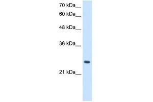 PPCDC antibody used at 2. (PPCDC antibody  (N-Term))