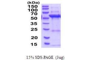 SDS-PAGE (SDS) image for 3-Hydroxy-3-Methylglutaryl-CoA Synthase 1 (Soluble) (HMGCS1) (AA 1-520) protein (His tag) (ABIN6387587)