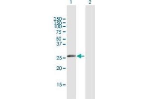 Western Blot analysis of IGKV1-5 expression in transfected 293T cell line by IGKV1-5 MaxPab polyclonal antibody. (IGKV1-5 antibody  (AA 1-235))