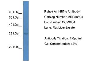 Western Blotting (WB) image for anti-Eukaryotic Translation Initiation Factor 4E (EIF4E) (C-Term) antibody (ABIN2787867) (EIF4E antibody  (C-Term))