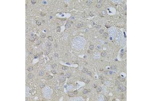 Immunohistochemistry of paraffin-embedded mouse brain using ACO1 antibody (ABIN1877037) (40x lens). (Aconitase 1 antibody)