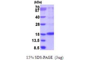 SDS-PAGE (SDS) image for Vascular Endothelial Growth Factor A (VEGFA) (AA 27-146) protein (His tag) (ABIN6387521) (VEGFA Protein (AA 27-146) (His tag))