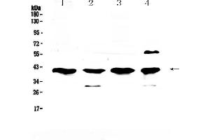 Western blot analysis of VEGFD using anti-VEGFD antibody . (VEGFD antibody  (AA 89-205))