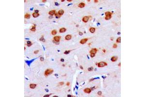 Immunohistochemical analysis of DUSP16 staining in human brain formalin fixed paraffin embedded tissue section. (DUSP16 antibody  (C-Term))