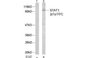 Image no. 2 for anti-Signal Transducer and Activator of Transcription 1, 91kDa (STAT1) (pTyr701) antibody (ABIN196689) (STAT1 antibody  (pTyr701))