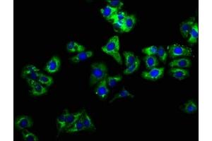 Immunofluorescence staining of HepG2 cells with ABIN7157950 at 1:166, counter-stained with DAPI. (LIME antibody  (AA 170-295))