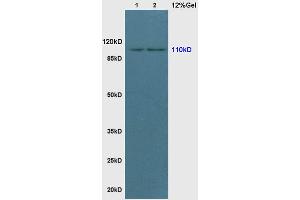 L1 rat brain lysates L2 rat colon lysates probed with Anti phospho-PI3KCA(TYR317) Polyclonal Antibody, Unconjugated (ABIN711521) at 1:200 in 4 °C. (PIK3CA antibody  (pTyr317))