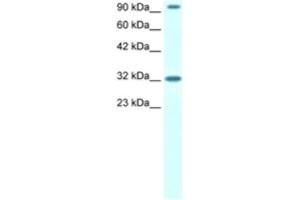 Western Blotting (WB) image for anti-CIon Channel antibody (ABIN2460486) (CIon Channel antibody)